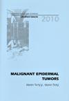 Malignant Epidermal Tumors