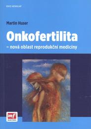 Onkofertilita