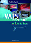 VATS lobektomie krok za krokem