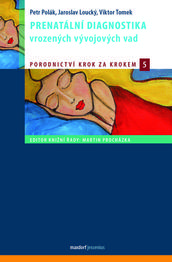 Prenatální diagnostika