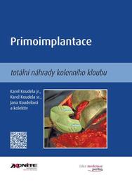 Primoimplantace